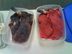 Nhìn lá phổi sau khi hút 60 điếu thuốc, bạn sẽ kinh hãi như thế nào