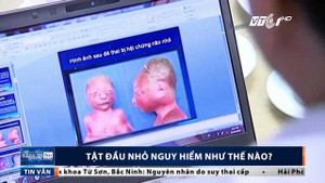 Tật đầu nhỏ nguy hiểm như thế nào?