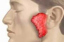 Bệnh quai bị có thể dẫn đến vô sinh như thế nào?