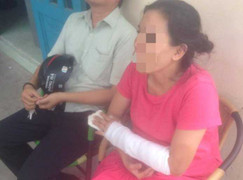 2 'nữ tướng cướp 16 tuổi' chém người cướp xe giữa TP.HCM: Nạn nhân có thai 7 tháng