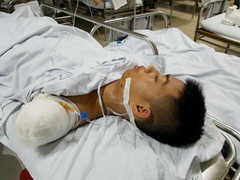 Cư dân mạng xôn xao chuyện chàng trai cứu bạn bị ô tô cán cụt tay