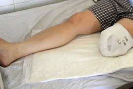 Thông tin mới về căn bệnh muốn hủy hoại cơ thể khiến y học tranh cãi dữ dội