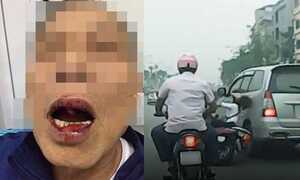 Sau vụ cán bộ Sở ngoại vụ đánh người, Hà Nội sắp ra quy tắc ứng xử
