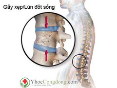 Đuổi bắt gà, rơi xuống giếng sâu, trẻ bị gãy cột sống