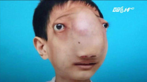 Hành trình gian nan tìm lại khuôn mặt của nam thanh niên Thanh Hóa