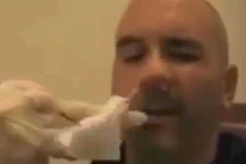 Clip: Bác sỹ gắp con sán dài 1,5m từ mũi người đàn ông