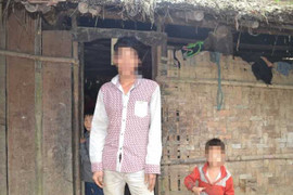 Chuyện lạ ở Hà Giang: Những đứa trẻ mang trên người 2 'của quý'