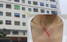 Khuyên không nhổ nước bọt nơi công cộng, một phụ nữ bị hành hung trong thang máy