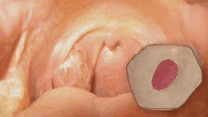 Miệng 'bốc mùi' là do căn bệnh nguy hiểm này