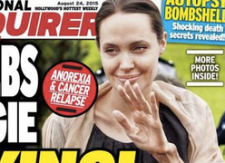 Angelina Jolie giờ đây chỉ còn 34 kg dù cao gần 1m70?