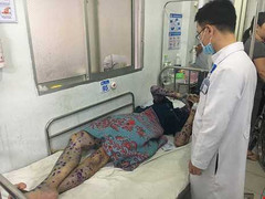 Hàng trăm công nhân trong ổ dịch thủy đậu