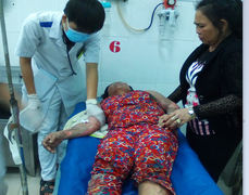 Bật bếp gas nấu nước tắm buổi tối, 1 phụ nữ nguy kịch