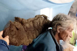 Dị nhân có mái tóc 'ma làm' hãi hùng sau trận ốm liệt giường ở Quảng Ninh