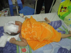 Bé trai 15 tháng tuổi văng khỏi xe máy