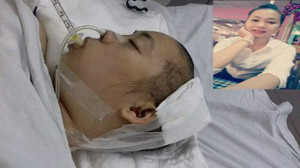 Số phận hẩm hiu của cô gái xinh đẹp bị tai nạn chấn thương sọ não