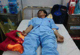 Công an xã vô cớ xông vào nhà dân đánh người