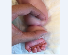 Nhờ 'chat' Facebook, người cha lặn lội đưa con sang Việt Nam phẫu thuật