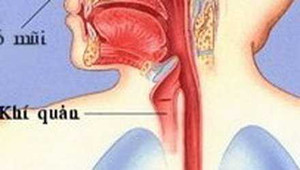 Phẫu thuật khối u hiếm gặp ở vùng cổ