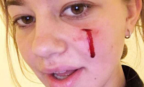 Chó cưng của ông Obama cắn nữ du khách thăm Nhà trắng