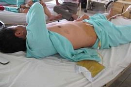 Đang nằm ngủ, bị bạn cắt phăng 'của quý'