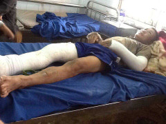 Cuối năm không trả tiền công, còn đánh gãy chân tay nhân viên