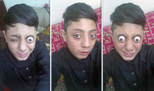 Kinh ngạc 'dị nhân' 14 tuổi có biệt tài... kéo mắt ra khỏi tròng