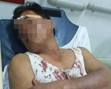 Can ngăn trai làng hỗn chiến, một công an viên bị đánh vỡ đầu