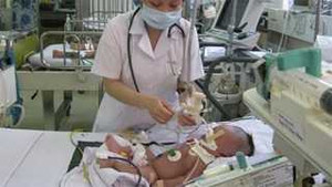 Bé trai sinh non, cắn dây rốn bằng dao lam nhập viện nguy kịch