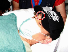 Lưu Đức Hoa cần đến 7 người chăm sóc tại bệnh viện