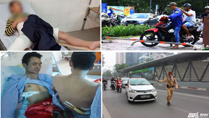 Học sinh bị xe tông gãy chân trong sân trường, người đàn ông bị đâm khi cứu người gặp nạn gây 'bão' mạng