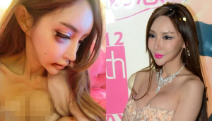 Siêu mẫu tung ảnh bị bạn trai đánh đập dã man suốt 3 năm