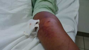 Vũng Tàu: Rắn độc ồ ạt bò ra ngoài hang tấn công người