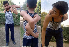 Kinh ngạc xem 'dị nhân' 17 tuổi vặn xoắn vai 360 độ, uốn dẻo siêu phàm