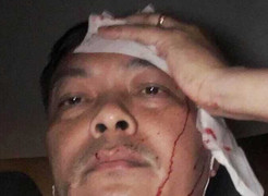 Giám đốc nhân sự cà phê Trung Nguyên bị đánh ở Sài Gòn