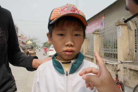 Bị bạn bắn que xiên thịt trúng mắt, một học sinh lớp 3 bị mù: Phòng giáo dục vào cuộc