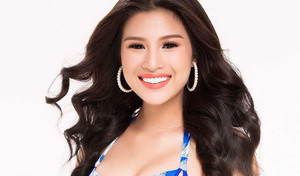 Nguyễn Thị Thành bị tước danh hiệu á khôi vì sửa răng