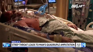 Bệnh lạ tại Mỹ: Cụt tứ chi chỉ vì... viêm họng