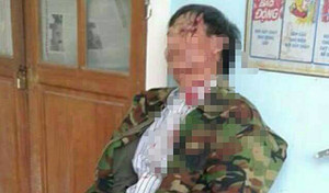 Dân tố bị trưởng công an xã đánh vỡ đầu vì ghi âm buổi làm việc