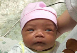 Xót xa bé gái 1 tháng tuổi mang ba căn bệnh quái ác trên người