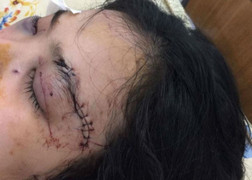 Cô gái cầm đầu 20 giang hồ 'truy sát', cắt tai thiếu nữ ở Sài Gòn