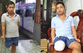 Nạn nhân bị cưa chân đề nghị khởi tố bác sĩ