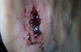 Kỷ luật cô giáo mầm non 'quệt tay' khiến học sinh chảy máu tai