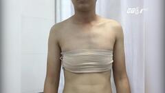 Kỳ lạ người có bộ phận sinh dục nửa nam nửa nữ