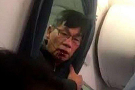 Bác sỹ gốc Việt bị đánh dã man, lôi khỏi máy bay nói thương tích đầy mình