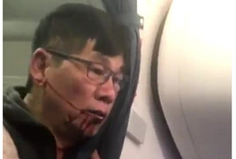 Hành khách gốc Việt bị United Airlines đánh đập dã man có cơ thắng kiện 'nhiều triệu USD'
