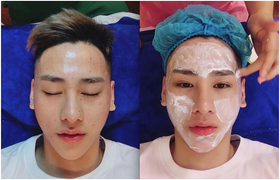 ‘Vẻ đẹp tự nhiên không dao kéo’ dành cho Nam