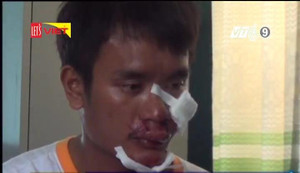 Bị giật điện thoại, cô gái truy đuổi, đạp cướp ngã sưng mặt