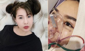 Quế Vân bất ngờ công khai quá trình làm lại toàn bộ gương mặt