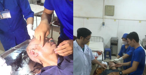 Người đàn ông bất ngờ bị chấn thương sọ não sau một ngày tạm giam