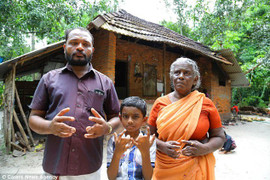 'Lời nguyền' suốt 90 năm khiến 140 người trong một dòng họ mang bàn tay nhện